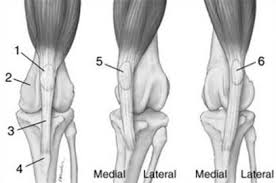 Patella luksasjon